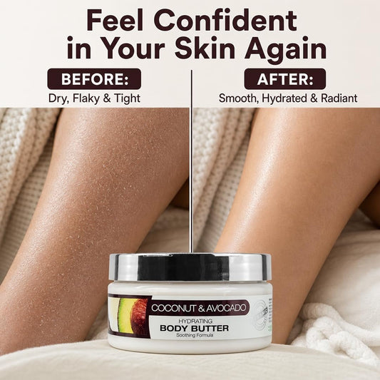 Coconut & Avocado | Hydrating Body Butter for Dry Skin | 8 fl oz | ORIGEM by ORIGEM | SH Salons
