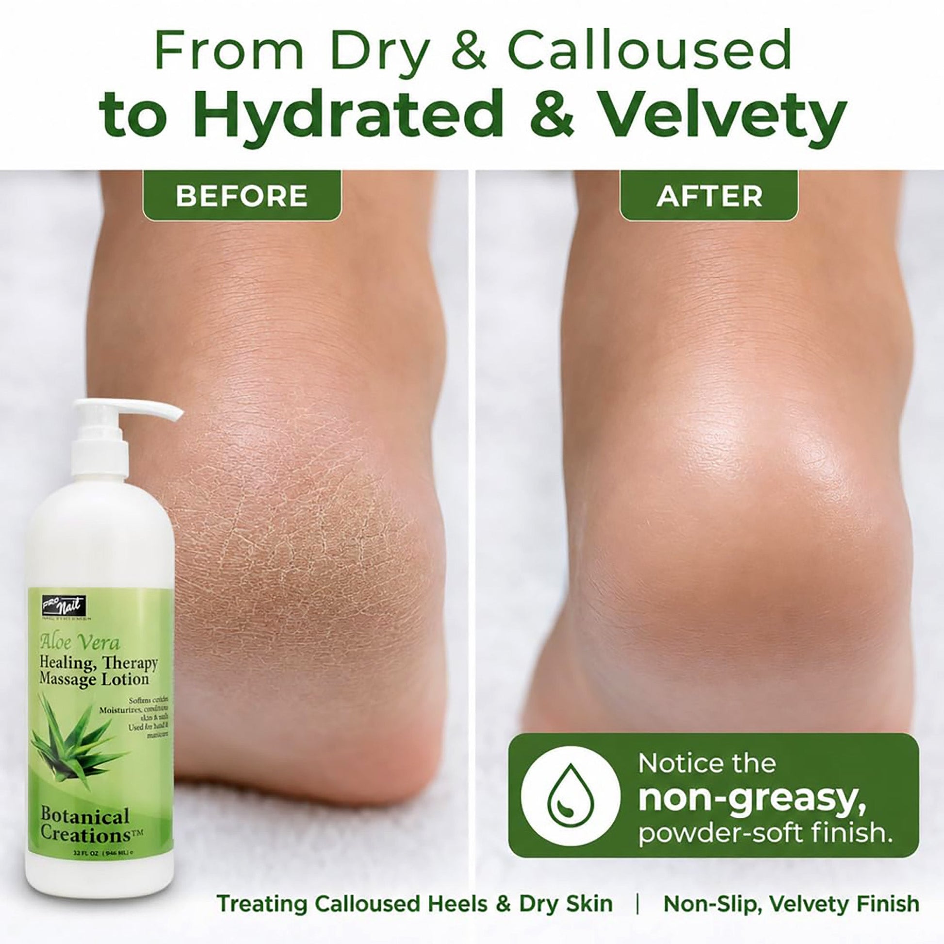 Aloe Vera | Spa & Pedicure Massage Lotion 32 fl oz – Dual - Phase Thermal Treatment | PRO NAIL by PRO NAIL | SH Salons